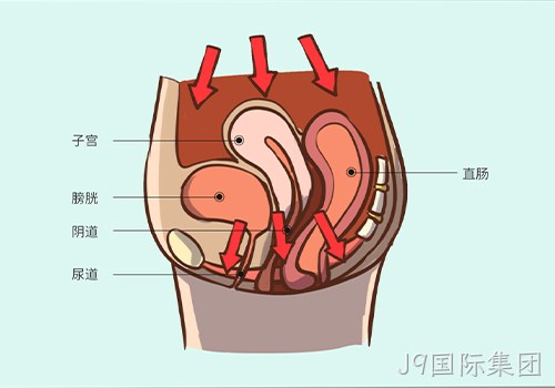 助力女性盆底功能健康发展，J9国际集团推出高频评估电灼仪